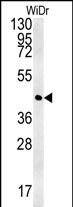 CCYL1 Antibody  (N-term) (Cat. #AP5730a) western blot analysis in WiDr cell line lysates (35ug/lane).This demonstrates the CCYL1 antibody detected the CCYL1 protein (arrow).