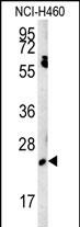 WB - EBPL Antibody (C-term) AP5735B