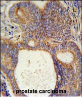 IHC-P - LYSMD1 Antibody (C-term) AP5745B