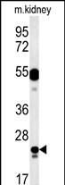 WB - LYSMD1 Antibody (C-term) AP5745B
