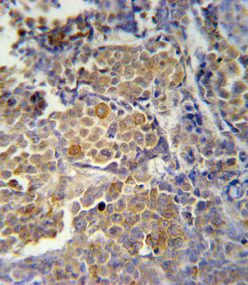 IHC-P - KIR2DS2 Antibody (Center) AP5764C