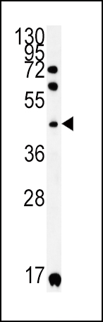 WB - KIR2DS2 Antibody (Center) AP5764C