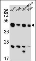 WB - BIN2 Antibody (N-term) AP5779a