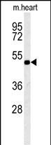 WB - KCNV1 Antibody (N-term) AP5787a