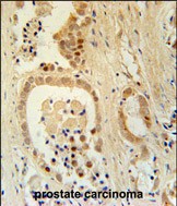 IHC-P - Z385B Antibody  (N-term) AP5790b