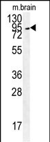 GIT1-S388 Antibody (Center) (Cat. #AP7416f) western blot analysis in mouse brain tissue lysates (35ug/lane).This demonstrates the GIT1 antibody detected the GIT1 protein (arrow).