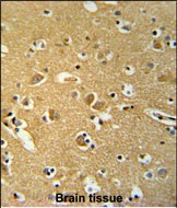 IHC-P - HSPC142 Antibody (N-term) AP8573a