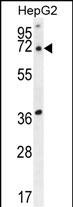ACOT11 Antibody (C-term) (Cat. #AP10130b) western blot analysis in HepG2 cell line lysates (35ug/lane).This demonstrates the ACOT11 antibody detected the ACOT11 protein (arrow).