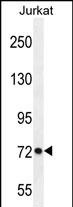 PCDHGC3 Antibody (Center) (Cat. #AP10141c) western blot analysis in Jurkat cell line lysates (35ug/lane).This demonstrates the PCDHGC3 antibody detected the PCDHGC3 protein (arrow).