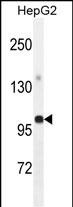 GPAM Antibody (Center) (Cat. #AP10150c) western blot analysis in HepG2 cell line lysates (35ug/lane).This demonstrates the GPAM antibody detected the GPAM protein (arrow).