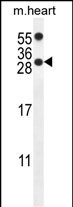 PP1R14C Antibody (C-term) (Cat. #AP10151b) western blot analysis in mouse heart tissue lysates (35ug/lane).This demonstrates the PP1R14C antibody detected the PP1R14C protein (arrow).