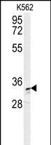 AKR1C3 Antibody (N-term) (Cat. #AP10158a) western blot analysis in K562 cell line lysates (35ug/lane).This demonstrates the AKR1C3 antibody detected the AKR1C3 protein (arrow).