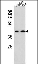 AADAT Antibody (Center) (Cat. #AP10161c) western blot analysis in HepG2,Y79 cell line lysates (35ug/lane).This demonstrates the AADAT antibody detected the AADAT protein (arrow).