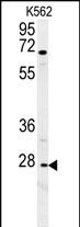 CXCR3 Antibody (Center) (Cat. #AP10170c) western blot analysis in K562 cell line lysates (35ug/lane).This demonstrates the CXCR3 antibody detected the CXCR3 protein (arrow).