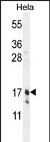 CLDN7 Antibody (C-term) (Cat. #AP10180b) western blot analysis in Hela cell line lysates (35ug/lane).This demonstrates the CLDN7 antibody detected the CLDN7 protein (arrow).