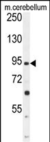 GABBR2 Antibody (C-term) (Cat. #AP10214b) western blot analysis in mouse cerebellum tissue lysates (35ug/lane).This demonstrates the GABBR2 antibody detected the GABBR2 protein (arrow).