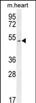WB - SLC10A4 Antibody (C-term) AP10250b