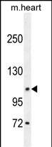 DAGLA Antibody (Center) (Cat. #AP10260c) western blot analysis in mouse heart tissue lysates (35ug/lane).This demonstrates the DAGLA antibody detected the DAGLA protein (arrow).