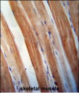 IHC-P - KBTBD5 Antibody (Center) AP10428c