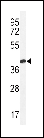 CLDN16 Antibody (N-term) (Cat. #AP10435a) western blot analysis in MDA-MB435 cell line lysates (35ug/lane).This demonstrates the CLDN16 antibody detected the CLDN16 protein (arrow).