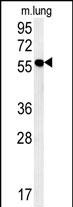 WB - ZMYND10 Antibody (C-term) AP5836b