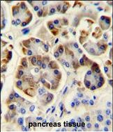 IHC-P - KCNJ6 Antibody (Center) AP5852c