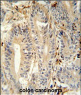 IHC-P - MEP1A Antibody (N-term) AP5858a