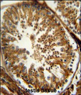 IHC-P - PAOX Antibody (Center) AP5864c