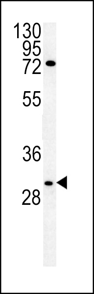 WB - CLDN12 Antibody (N-term) AP5874a