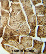 IHC-P - SMPD4 Antibody (N-term) AP5904a