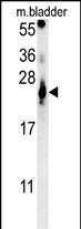 ATP5G2 Antibody (C-term) (Cat. #AP5906b) western blot analysis in mouse bladder tissue lysates (15ug/lane).This demonstrates the ATP5G2 antibody detected ATP5G2 protein (arrow).