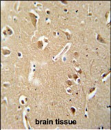 IHC-P - CILP2 Antibody (Center) AP5907c