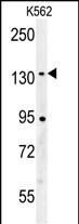 WB - CILP2 Antibody (Center) AP5907c