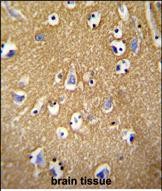 IHC-P - BCAN Antibody (C-term) AP5915b