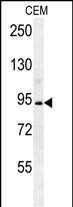 BCAN Antibody (C-term) (Cat. #AP5915b) western blot analysis in CEM cell line lysates (35ug/lane).This demonstrates the BCAN antibody detected the BCAN protein (arrow).
