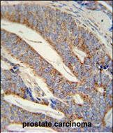 IHC-P - DACT1 Antibody (N-term) AP5921a