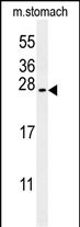 WB - SRTD3 Antibody  (N-term) AP5927a