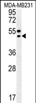 WB - TRAM2 Antibody (C-term) AP5996b