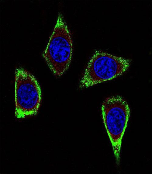 Confocal immunofluorescent analysis of RET Antibody (Ascites)(Cat#AM1869a) with MDA-MB231 cell followed by Alexa Fluor� 488-conjugated goat anti-mouse lgG (green).Actin filaments have been labeled with Alexa Fluor? 555 phalloidin (red). DAPI was used to stain the cell nuclear (blue).