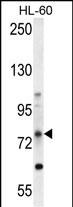 ABCD1 Antibody (Center) (Cat. #AP10454c) western blot analysis in HL-60 cell line lysates (35ug/lane).This demonstrates the ABCD1 antibody detected the ABCD1 protein (arrow).