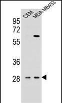 IL12B Antibody (C-term) (Cat. #AP10463b) western blot analysis in CEM,MDA-MB453 cell line lysates (35ug/lane).This demonstrates the IL12B antibody detected the IL12B protein (arrow).