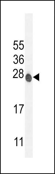 ATP6V0C Antibody (C-term) (Cat. #AP10470b) western blot analysis in mouse NIH-3T3 cell line lysates (35ug/lane).This demonstrates the ATP6V0C antibody detected the ATP6V0C protein (arrow).