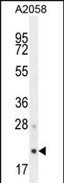 AP3S1 Antibody (N-term) (Cat. #AP10499a) western blot analysis in A2058 cell line lysates (35ug/lane).This demonstrates the AP3S1 antibody detected the AP3S1 protein (arrow).