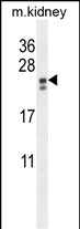PIGX Antibody  (N-term) (Cat. #AP10521a) western blot analysis in mouse kidney tissue lysates (35ug/lane).This demonstrates the PIGX antibody detected the PIGX protein (arrow).