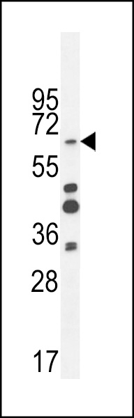 ZNF98 Antibody  (C-term) (Cat. #AP10523b) western blot analysis in MDA-MB435 cell line lysates (35ug/lane).This demonstrates the ZNF98 antibody detected the ZNF98 protein (arrow).