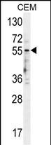 5HT3E Antibody  (Center) (Cat. #AP10528c) western blot analysis in CEM cell line lysates (35ug/lane).This demonstrates the 5HT3E antibody detected the 5HT3E protein (arrow).