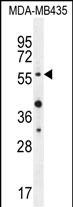 AKT1 (Thr308) Antibody (Cat. #AP10543a) western blot analysis in MDA-MB435 cell line lysates (35ug/lane).This demonstrates the AKT1 antibody detected the AKT1 protein (arrow).