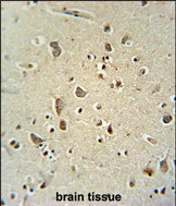 IHC-P - ATPGD1 Antibody (N-term) AP10580a