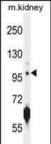 WB - ATPGD1 Antibody (N-term) AP10580a