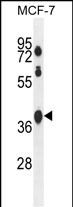 WB - SPATA2L Antibody (Center) AP10584c